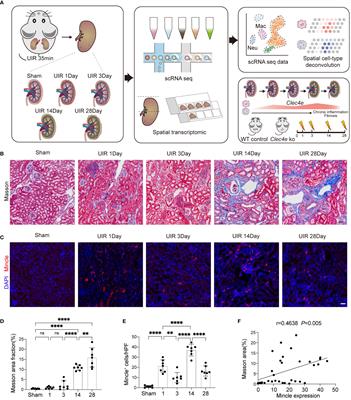 Mincle receptor in macrophage and neutrophil contributes to the unresolved inflammation during the transition from acute kidney injury to chronic kidney disease